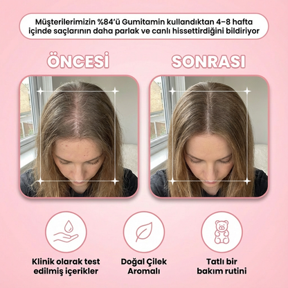 Gumitamin Keratin Saç ve Tırnak Vitamini