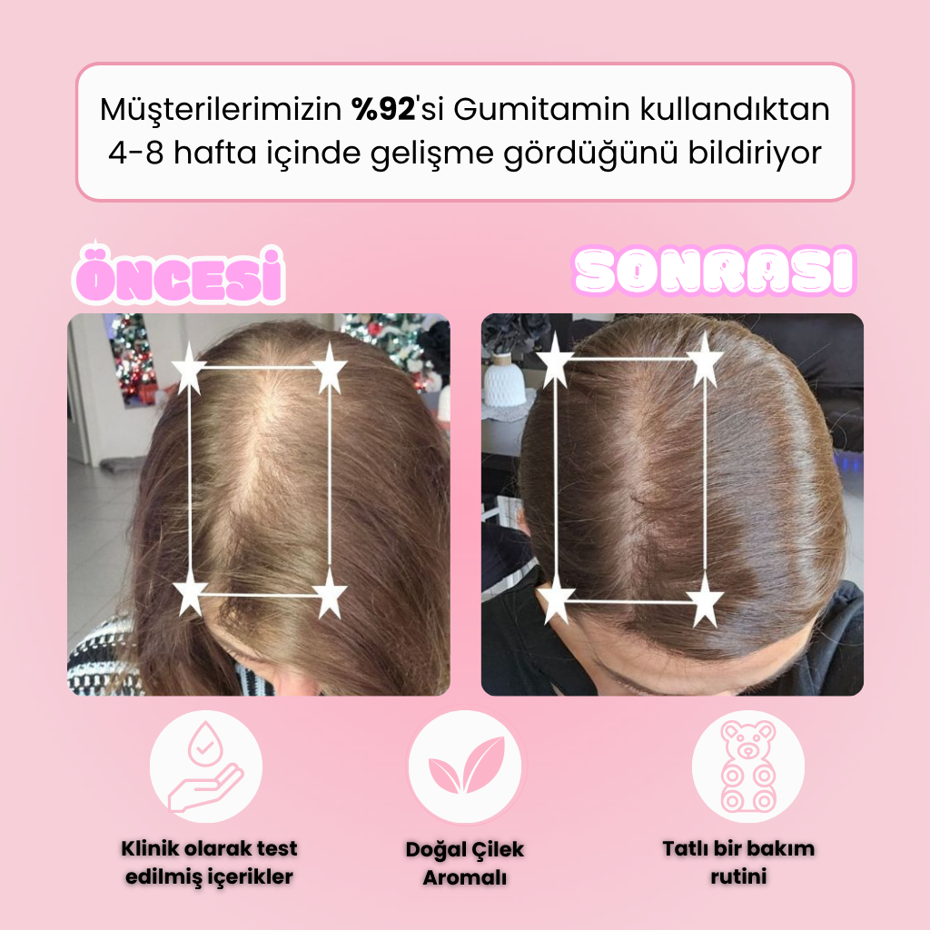 Gumitamin Keratin Saç ve Tırnak Vitamini